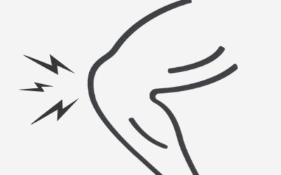 Patellofemorale smerter